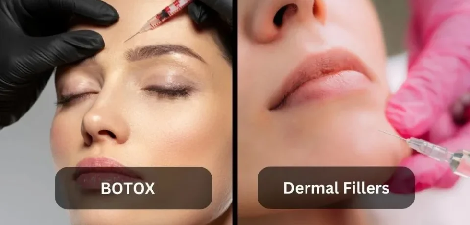 botx-vs-dermal-filler