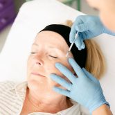 sculptra-treatment-st-albans