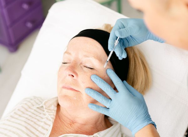 sculptra-treatment-st-albans