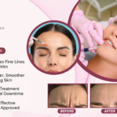 Modern-Aesthetic-Treatments-in-New-Jersey Modern Aesthetic Treatments in New Jersey
